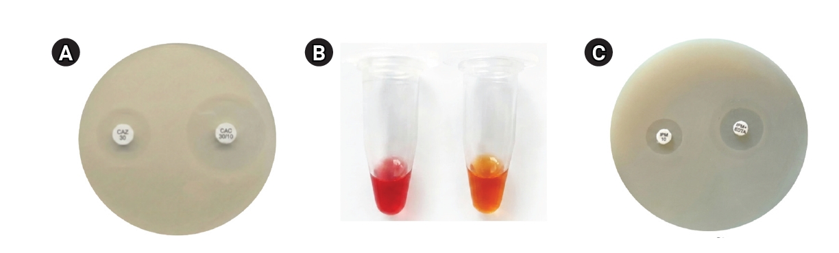 Objectives: This study characterized multidrug-resistant (MDR) bacteria in sewage, river, and marine ecosystems in South Gujarat, India. Methods: Water samples were collected from 25 hospital drainage, sewage treatment/pumping, Tapi River, and coasta